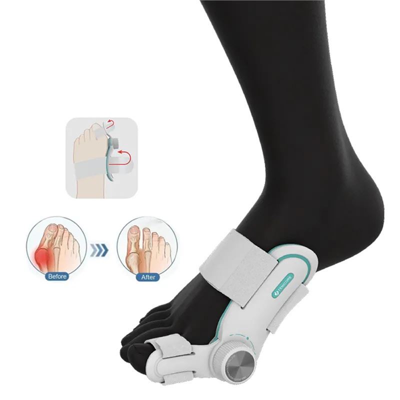 آتل اصلاح کننده انحراف انگشت پا TENICORE Bunion Corrector - 4