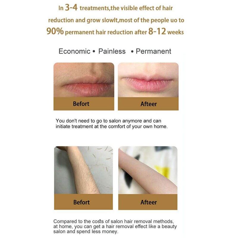 دستگاه لیزر خانگی IPL ICE Hair Removal Laser Painless - 3