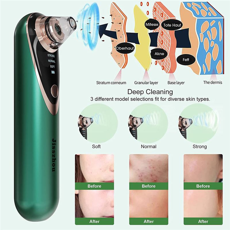 دستگاه میکرودرم مکنده جوش سر سیاه Jisszhou - 4