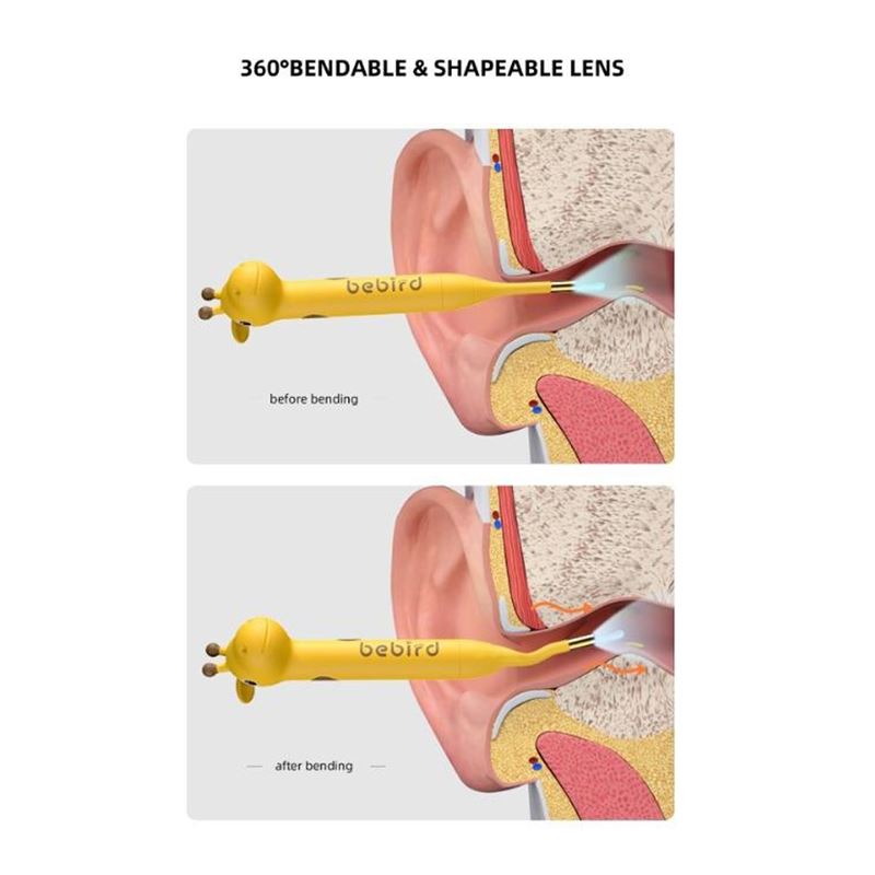 گوش پاک کن هوشمند شیائومی Bebird D3 Pro - 2
